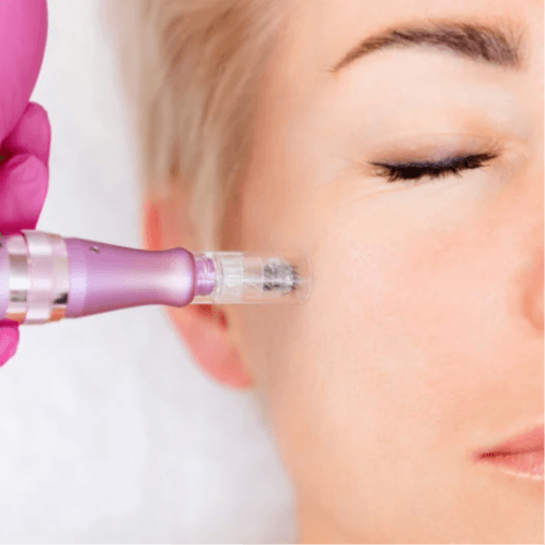 Microneedling 6 Pack