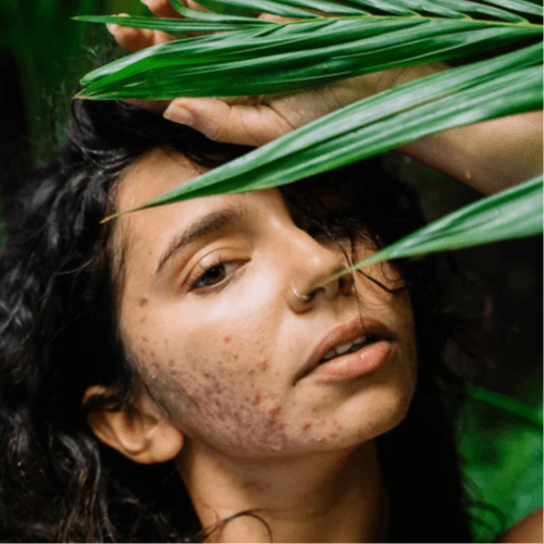 Skin Clearing Peel: Pack of 3 at Clair Elizabeth Beauty & Co: Massage, Skin, Beauty in Longmont, CO